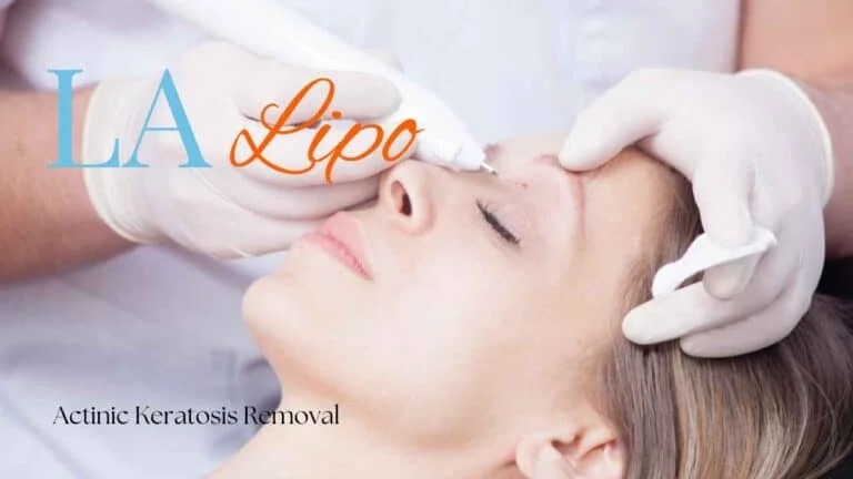 Woman receiving Actinic Keratosis Removal Treatment King's Cross