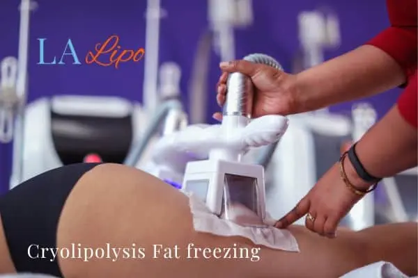 women getting fat freezing King's Cross