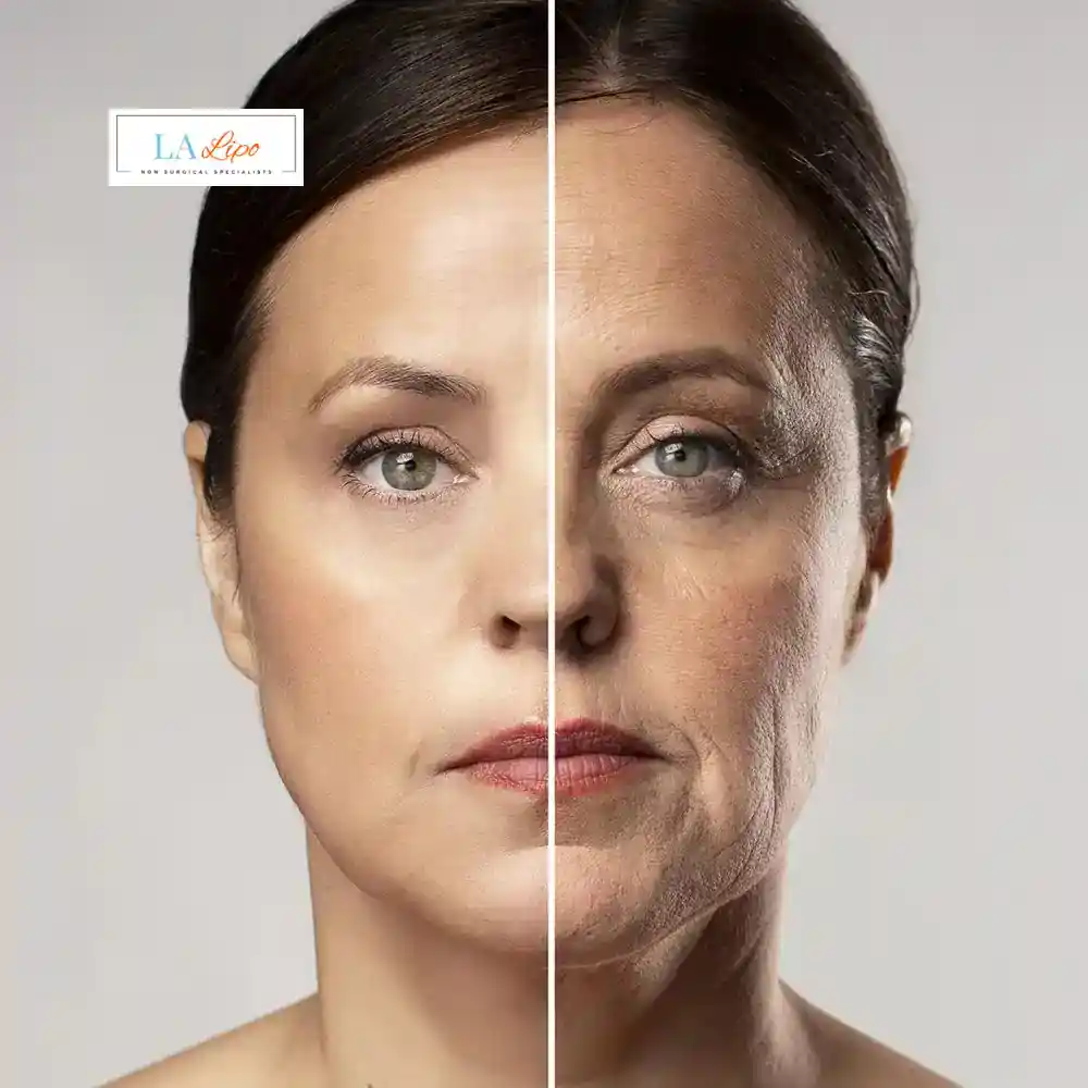 How Can You Tell If Non-Surgical Skin Tightening Is Right for You King's Cross?