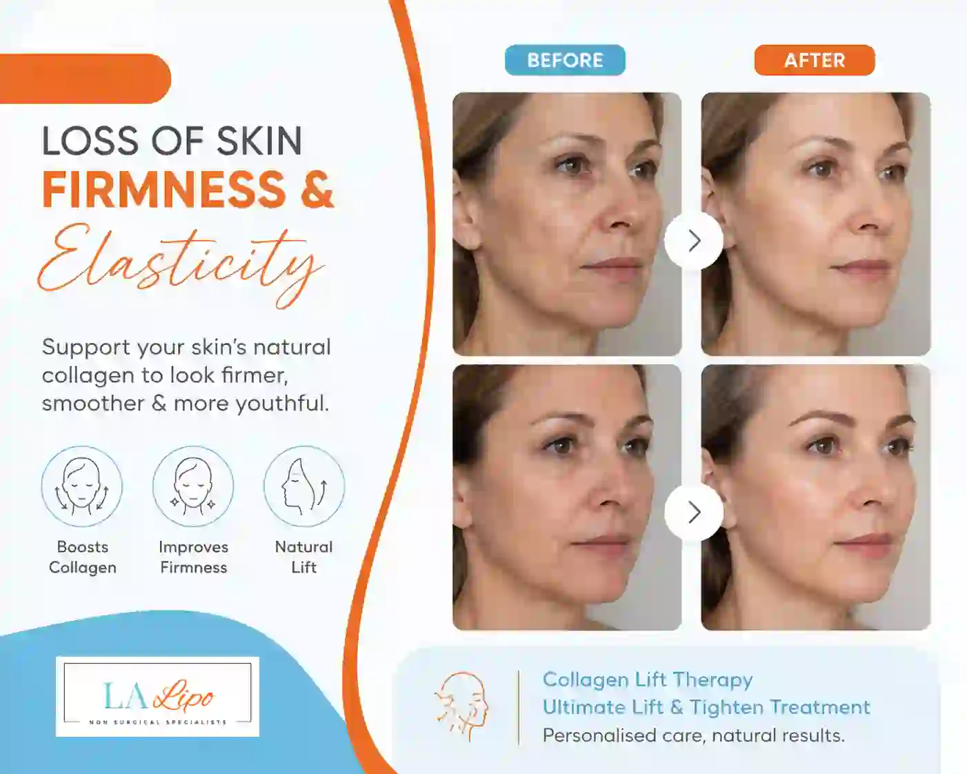 Sign #7: Loss of Skin Firmness and Elasticity King's Cross