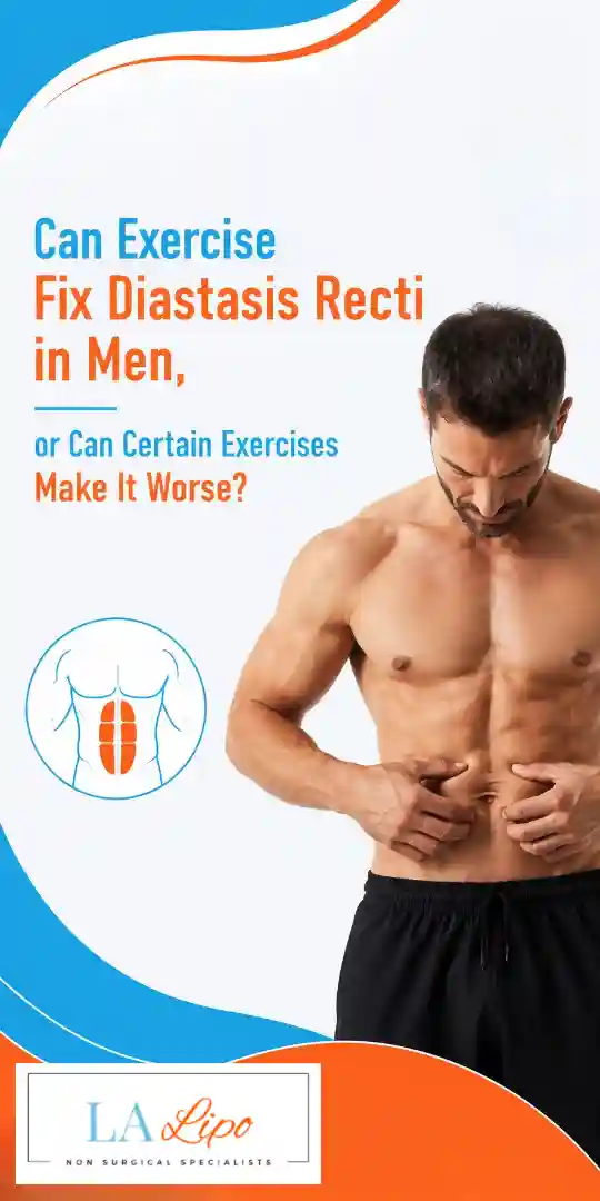 Can Exercise Fix Diastasis Recti in Men, or Can Certain Exercises Make It Worse King's Cross?